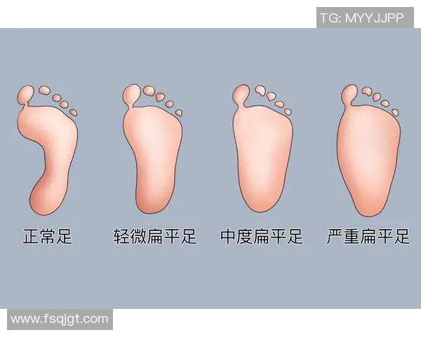 扁平足球员的挑战与成功：探索足球界的扁平足明星人物